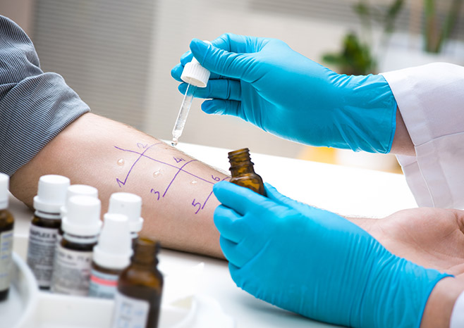 Allergy Tests 101 – What to Expect