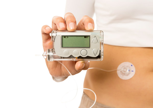 Get in the Know: Continuous Glucose Monitors (CGM) and Insulin Pumps<br />

